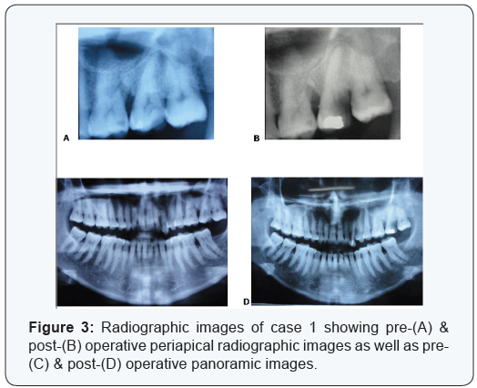 Click here to view Large Table