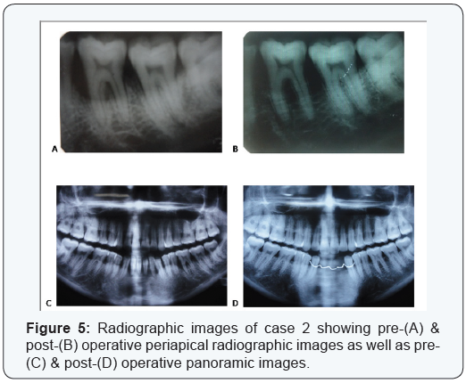 Click here to view Large Table