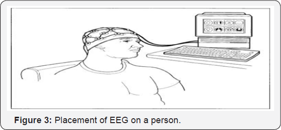 Click here to view Large Table 1