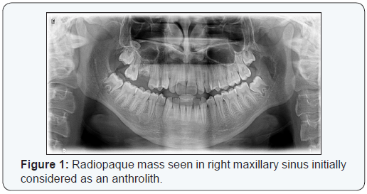 Click here to view Large Figure 1