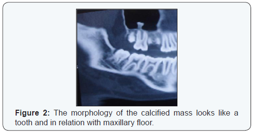 Click here to view Large Figure 2