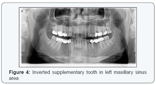 Click here to view Large Figure 4