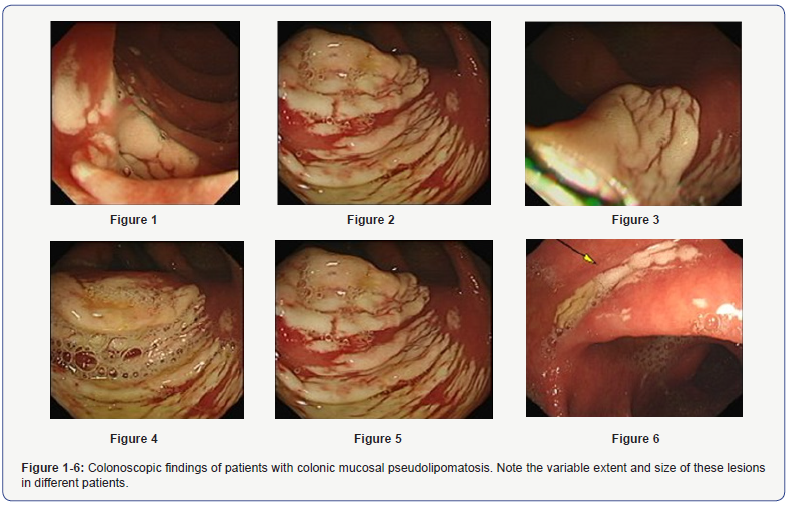 Click here to view Large Figure 1