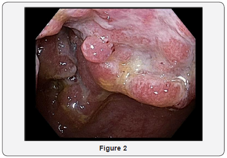 Click here to view Large Figure 2