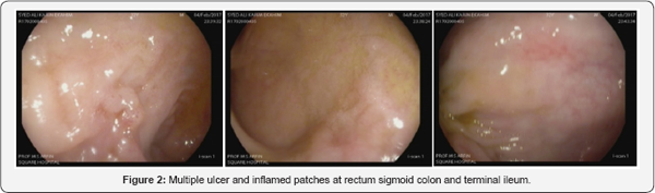 Click here to view Large Figure 2