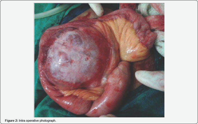 Click here to view Large Figure 2