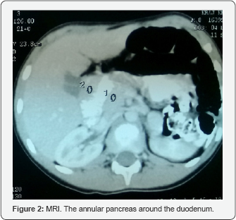 Click here to view Large Figure 2