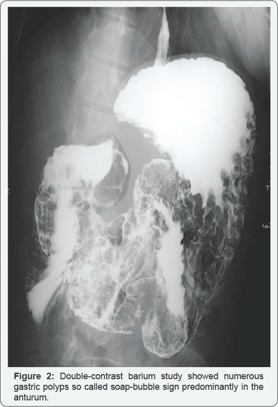 Click here to view Large Figure 2