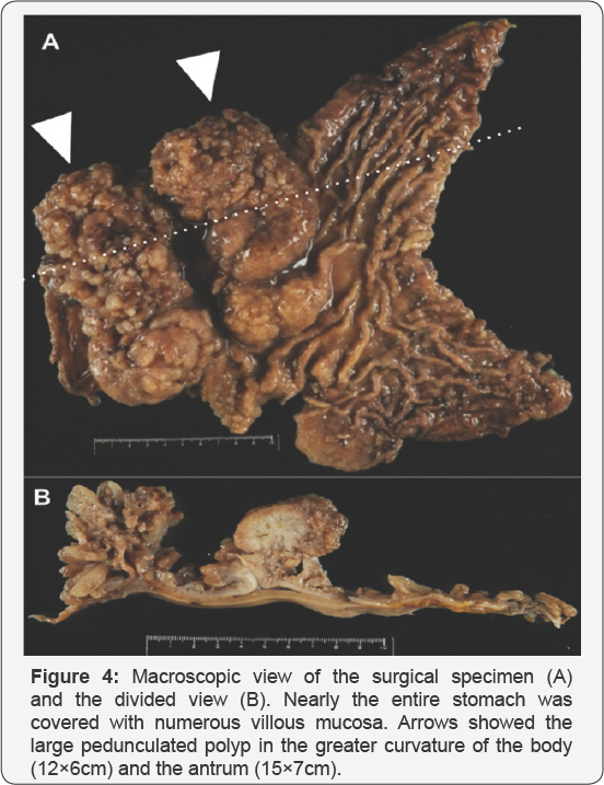 Click here to view Large Figure 4