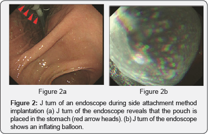 Click here to view Large Figure 2