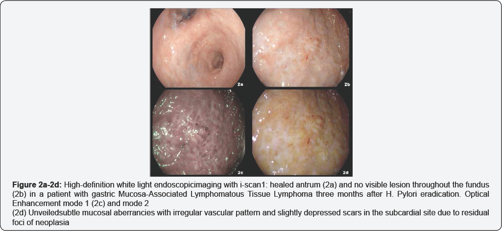 Click here to view Large Table 1