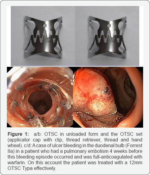 Click here to view Large Figure 1