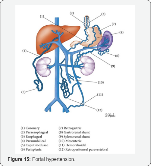 Click here to view Large Figure 15