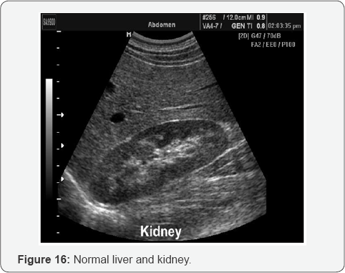 Click here to view Large Figure 16