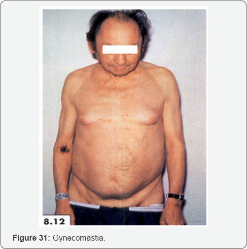 Click here to view Large Figure 31