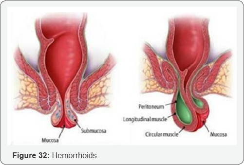 Click here to view Large Figure 32