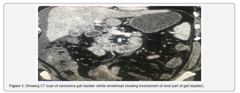 Click here to view Large Figure 1