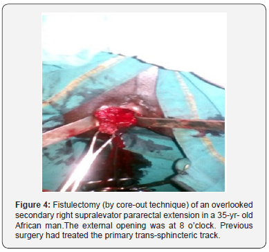 Click here to view Large Figure 4