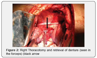 Click here to view Large Figure 2