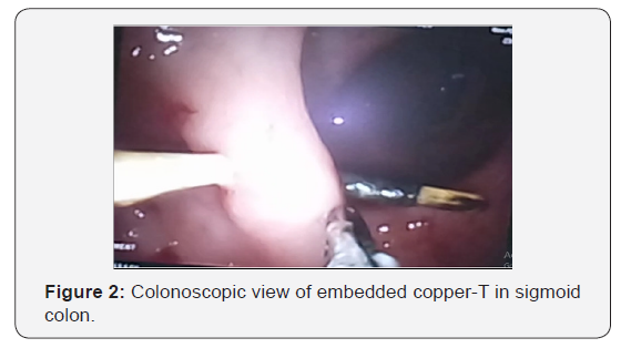 Click here to view Large Figure 2