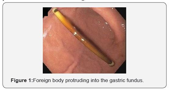 Click here to view Large Figure 1