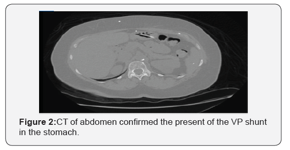 Click here to view Large Figure 2