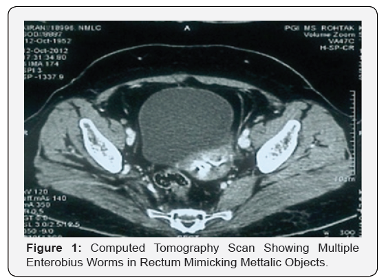 Click here to view Large Figure 1