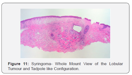 Click here to view Large Figure 11