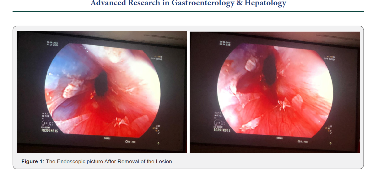 Click here to view Large Figure 1
