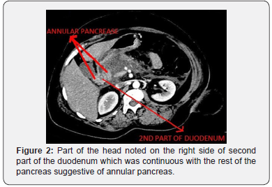 Click here to view Large Figure 2