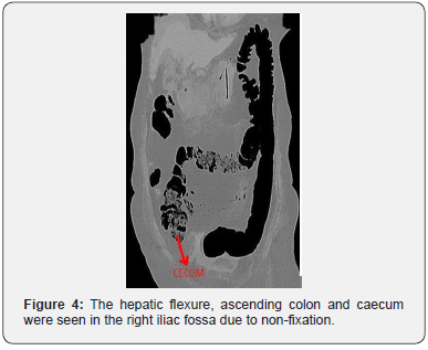 Click here to view Large Figure 4