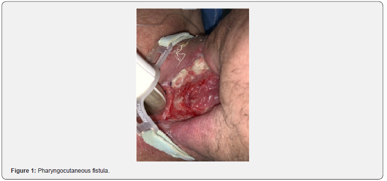 Click here to view Large Figure 1