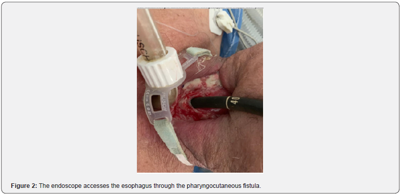 Click here to view Large Figure 2