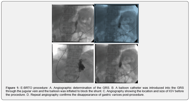 Click here to view Large Figure 1