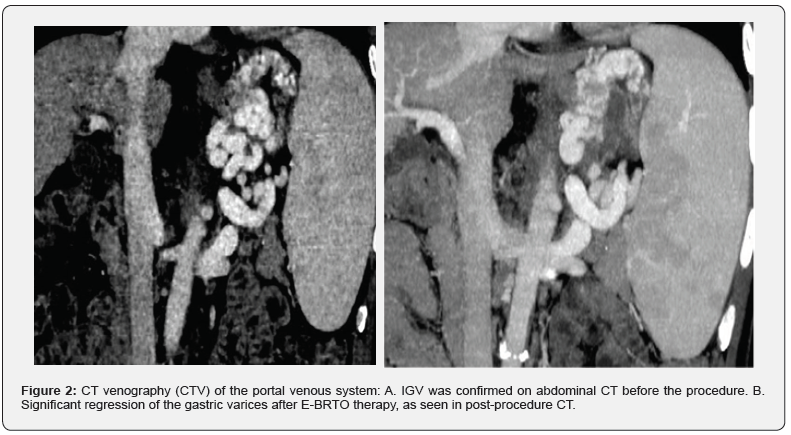 Click here to view Large Figure 2