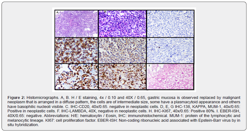 Click here to view Large Figure 2