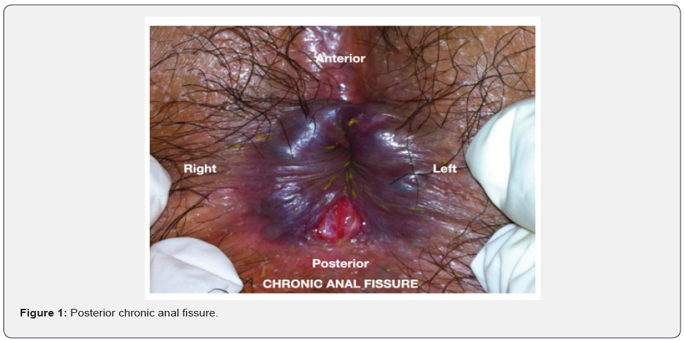 Click here to view Large Figure 1