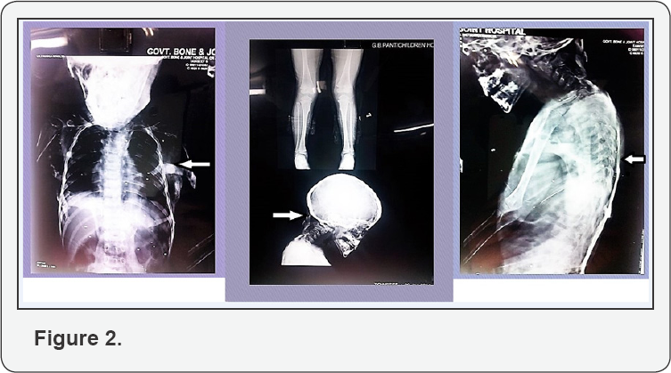 Click here to view Large Figure 2