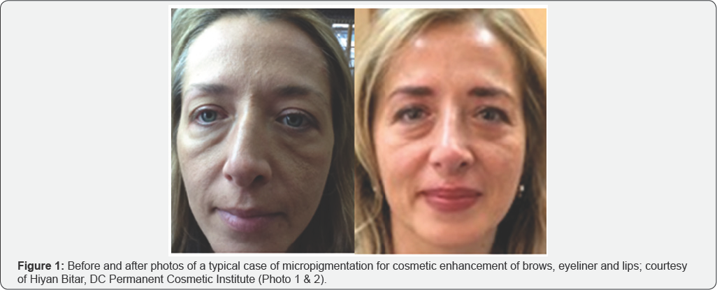 Click here to view Large Figure 1