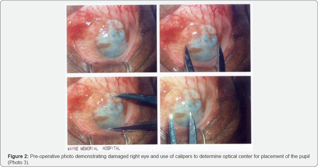 Click here to view Large Figure 2