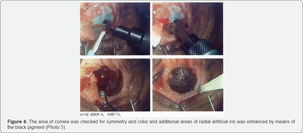 Click here to view Large Figure 4