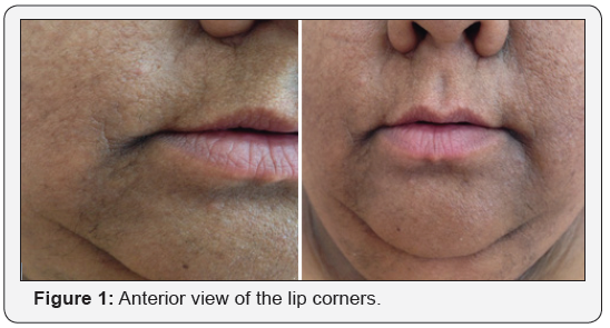 Click here to view Large Figure 1