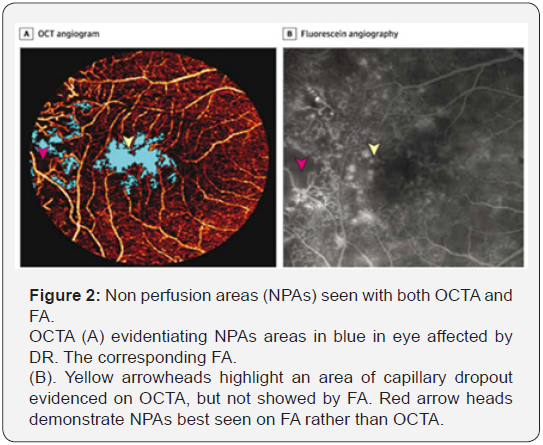 Click here to view Large Figure 2