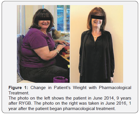 Click here to view Large Figure 1 Current Research in Diabetes & Obesity Journal
