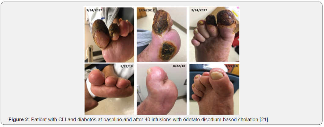 Click here to view Large Figure 2 Current Research in Diabetes & Obesity Journal