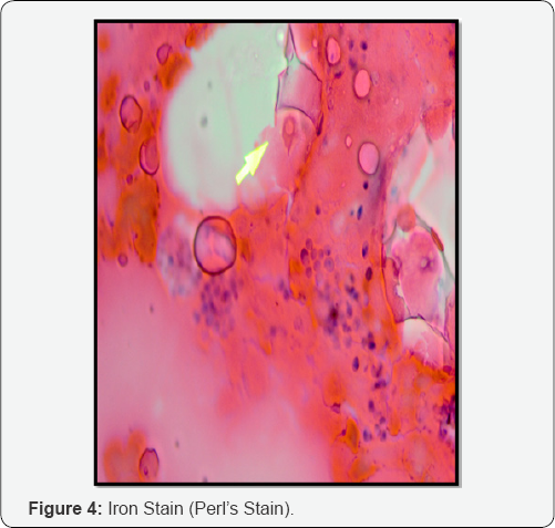 Click here to view Large Figure 4