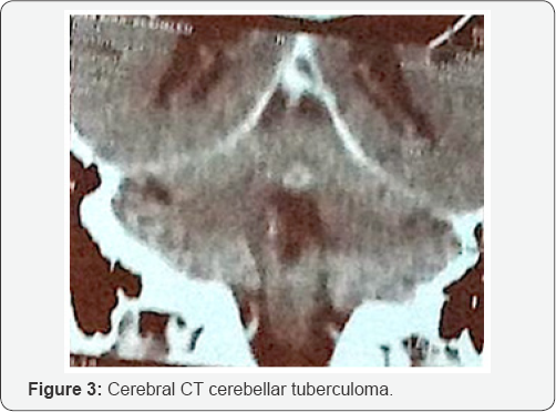 Click here to view Large Figure 3