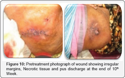 Click here to view Large Figure 10