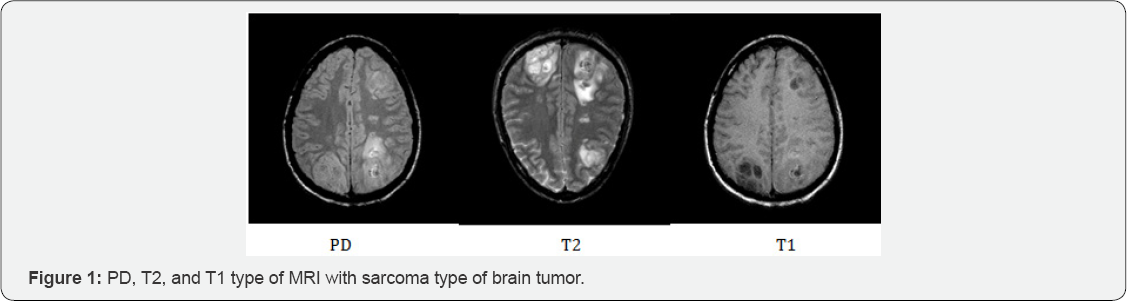 Click here to view Large Figure 1