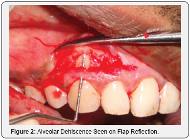 Click here to view Large Figure 2